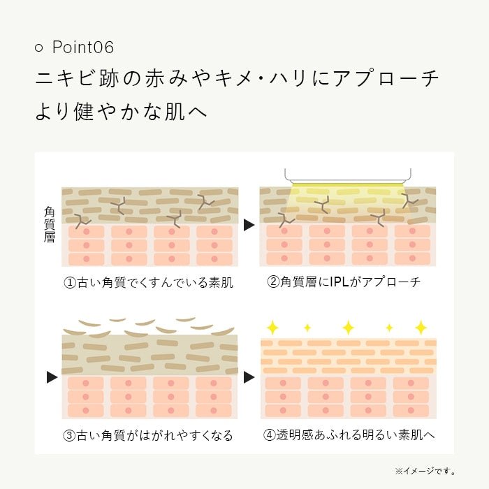 Kiralaステラボーテ IPL&LED 光美容器脱毛器 - アルバム オンラインストア