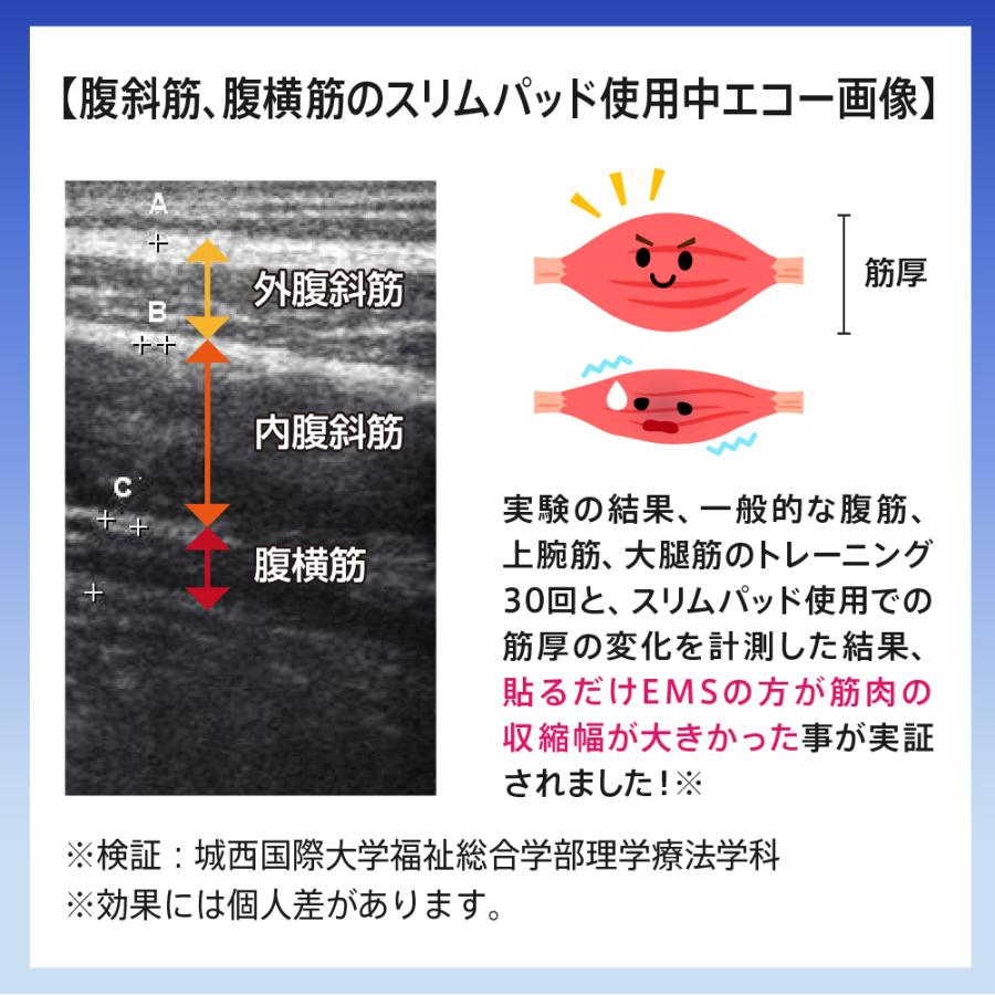 ウイルエーSLIMPAD CORE（スリムパッド コア）マッサージ機 - アルバム オンラインストア